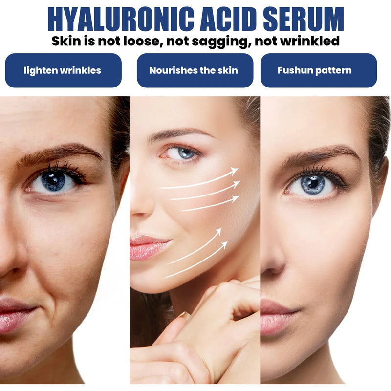 Ouhoe 50ml Hyaluronic Acid Anti Aging Face Serum Moisturizing Repair Redness Firming Facial Shrink Pores Skin Hydrating Serum