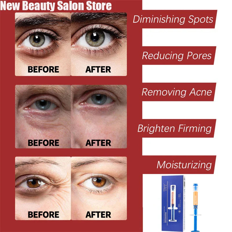 Retinol Wrinkle Remover Face Cream Firming Lifting Anti Aging Fade Fine Lines Moisturizing Whitening Repair Skin Care Cosmetics