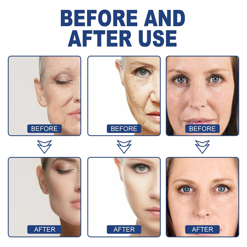 Ouhoe 50ml Hyaluronic Acid Anti Aging Face Serum Moisturizing Repair Redness Firming Facial Shrink Pores Skin Hydrating Serum