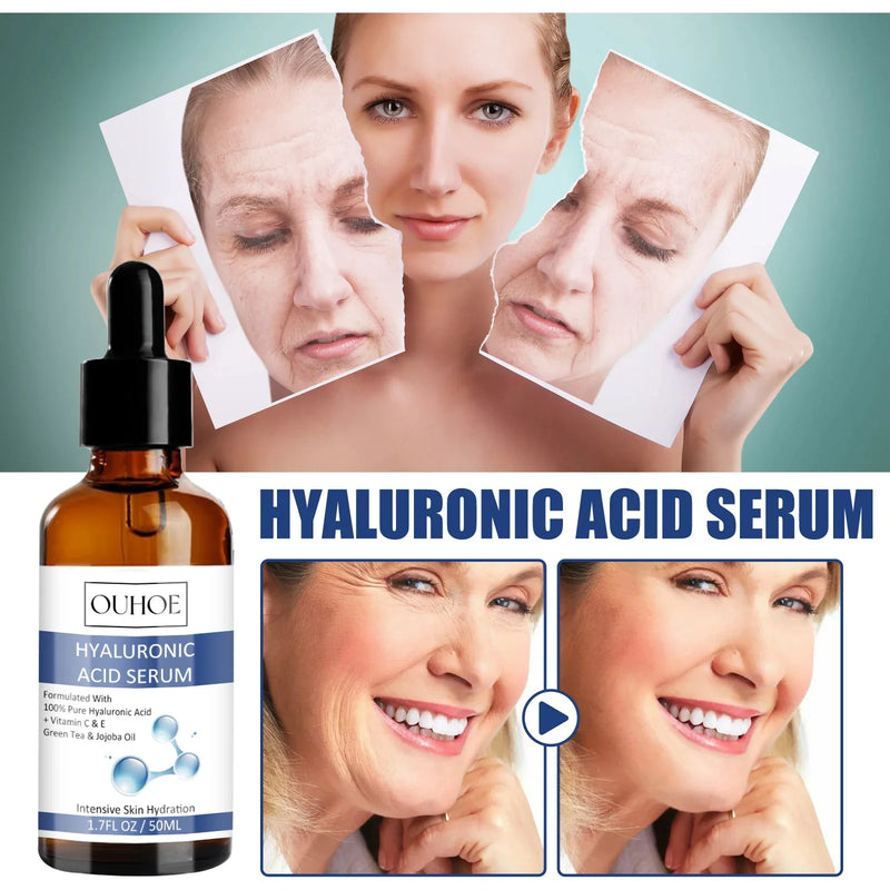 Ouhoe 50ml Hyaluronic Acid Anti Aging Face Serum Moisturizing Repair Redness Firming Facial Shrink Pores Skin Hydrating Serum