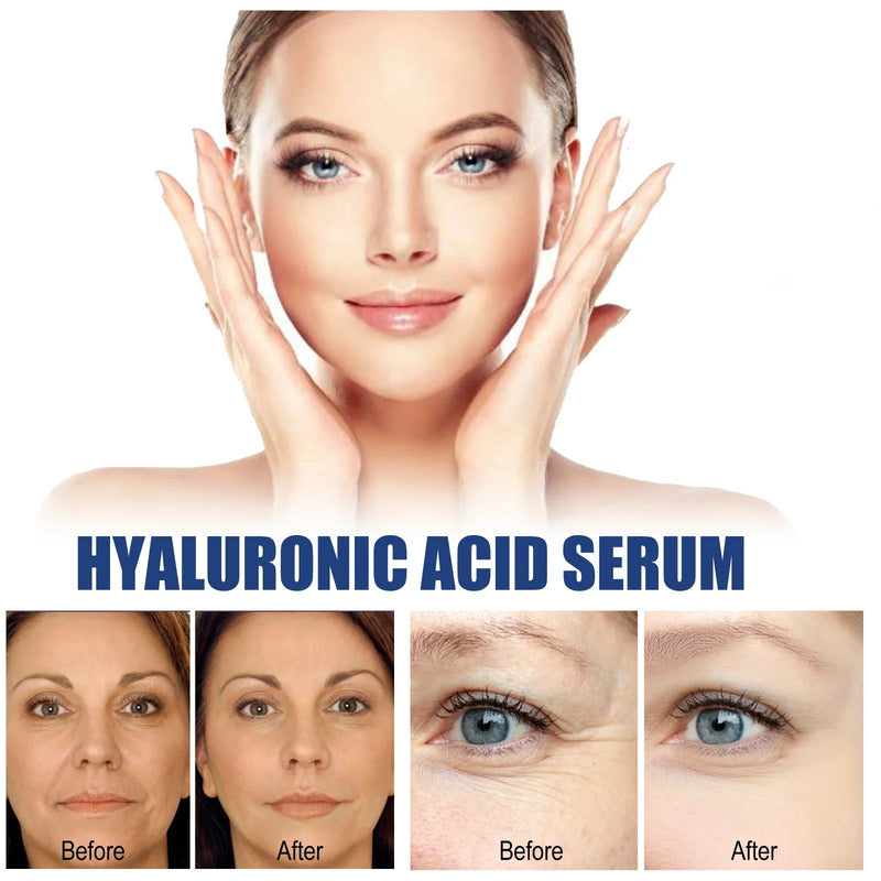 Ouhoe 50ml Hyaluronic Acid Anti Aging Face Serum Moisturizing Repair Redness Firming Facial Shrink Pores Skin Hydrating Serum