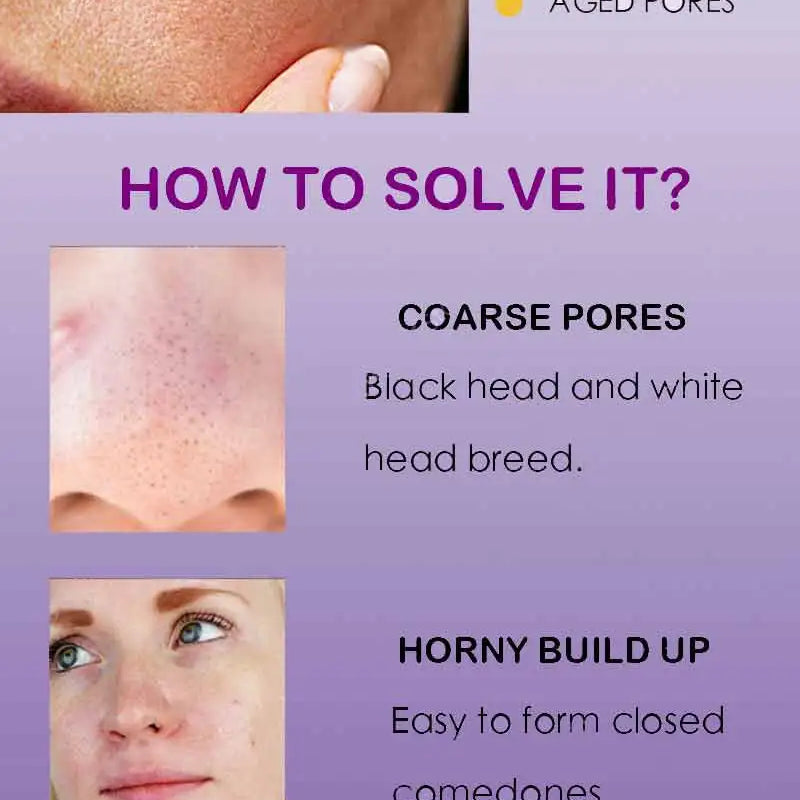 Pore Shrinking Serum Face Removing Large Pores Tightening Repairing Facial Pore Minimizing Essence Skin Care Beauty Firm skin